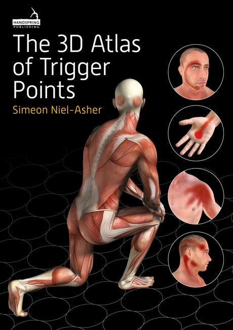 The 3D Atlas of Trigger Points