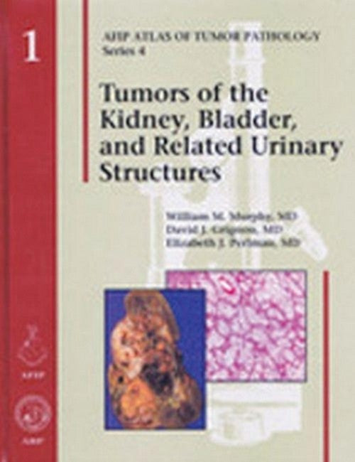 Tumors of the Kidney, Bladder, and Related Urinary Structures