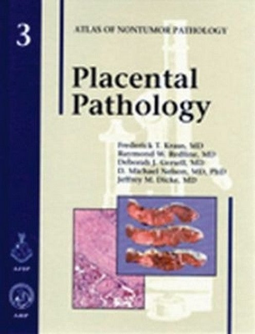 Placental Pathology