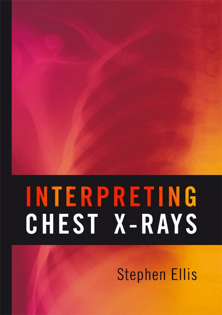 Interpreting Chest X-Rays 2/e