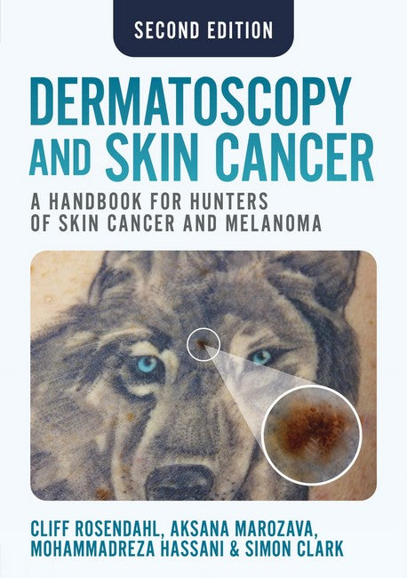 Dermatoscopy and Skin Cancer, second edition