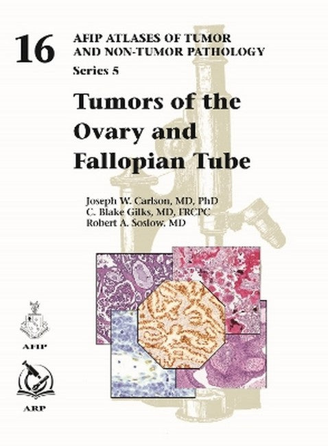 Tumors of the Ovary and Fallopian Tube