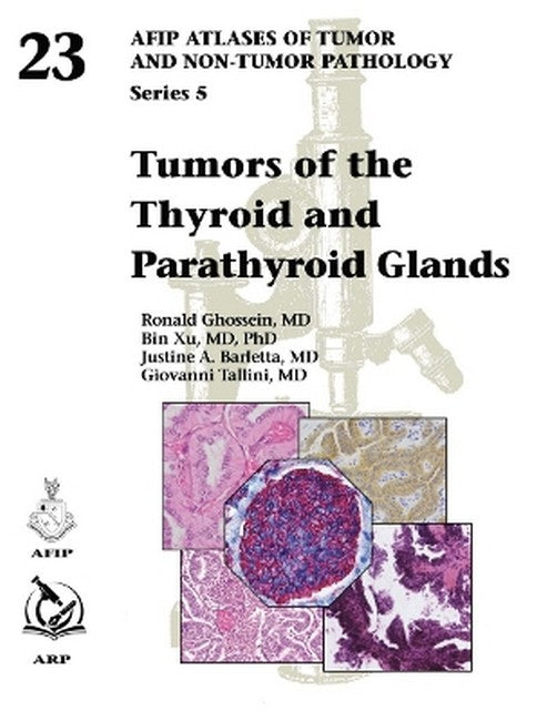 Tumors of the Thyroid and Parathyroid Glands