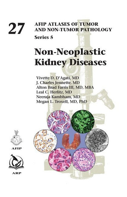 Non-Neoplastic Kidney Diseases