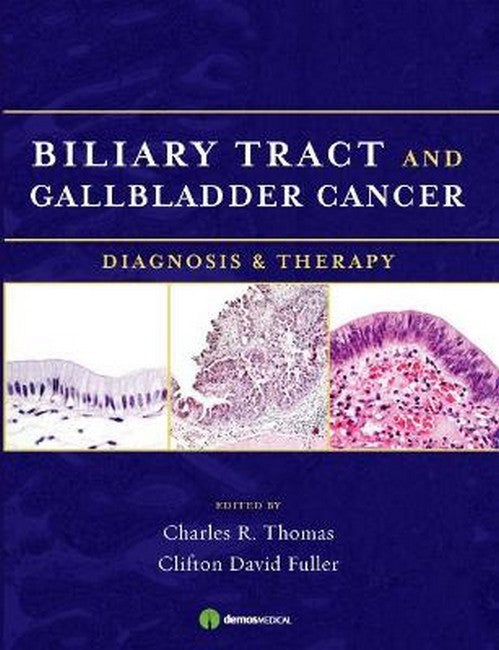 Biliary Tract and Gallbladder Cancer