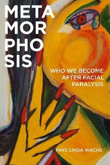 Metamorphosis
