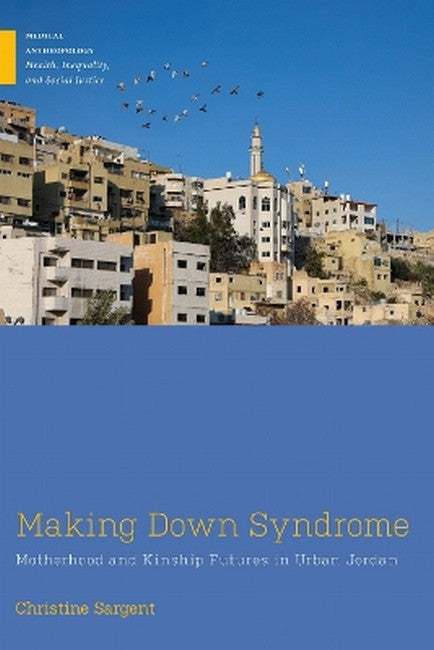 Making Down Syndrome