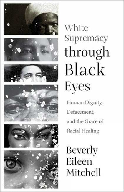 White Supremacy through Black Eyes