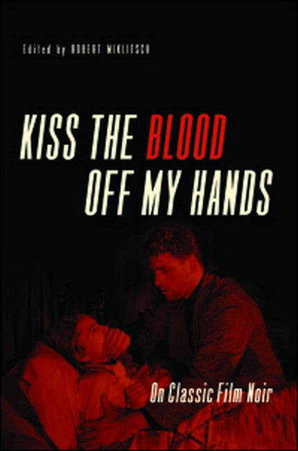 Kiss the Blood Off My Hands