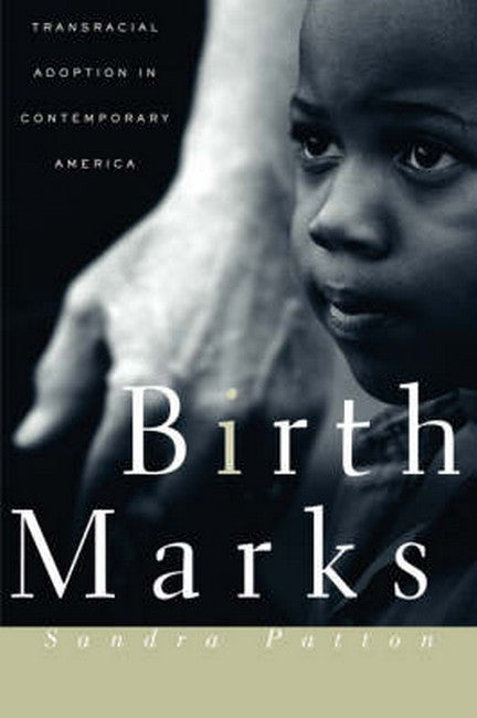 Birthmarks
