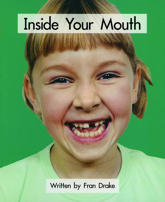 SIC - Lvl 21 Inside Your Mouth