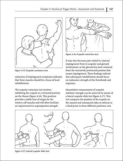 Understanding Fascia, Tensegrity, and Myofascial Trigger Points