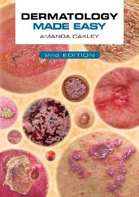 Dermatology Made Easy 2/e