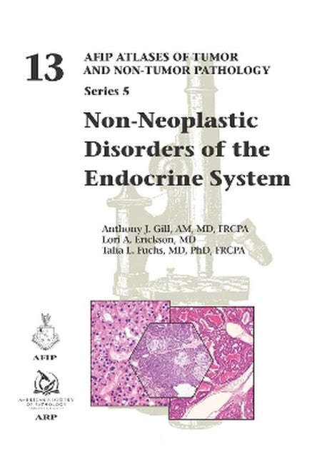Non-Neoplastic Disorders of the Endocrine System