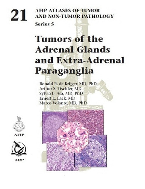Tumors of the Adrenal Glands and Extra-Adrenal Paraganglia