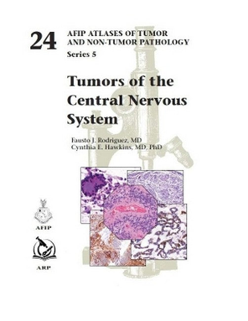 Tumors of the Central Nervous System