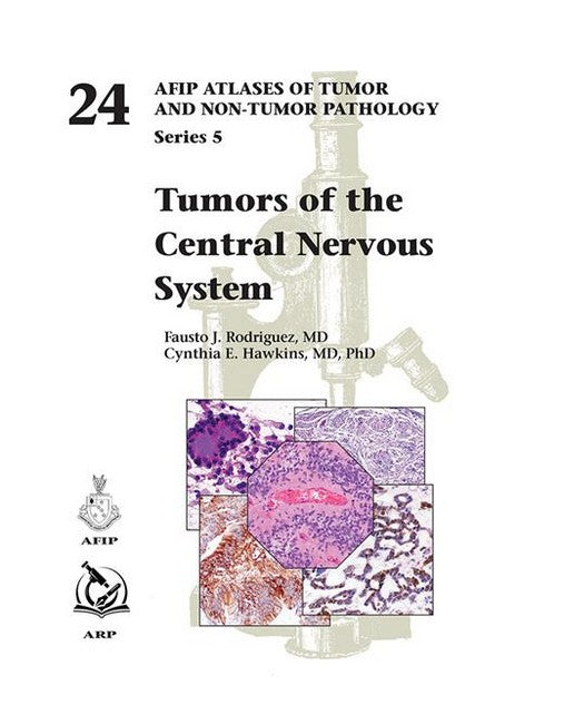 Tumors of the Central Nervous System