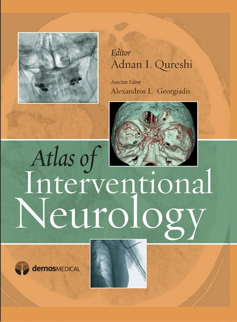 Atlas of Interventional Neurology H/C