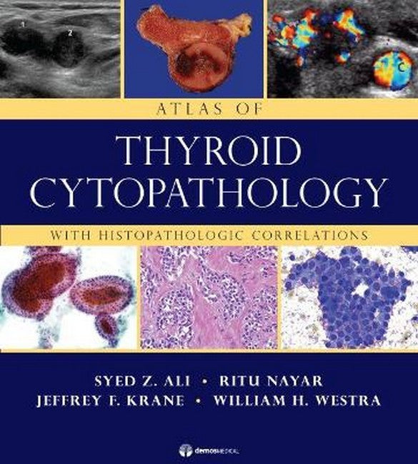 Atlas of Thryoid Cytopathology H/C