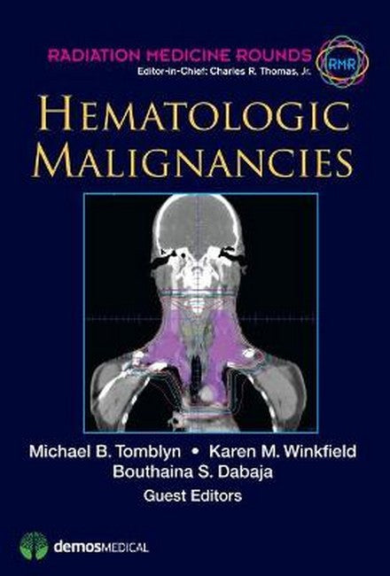 Hematologic Malignancies