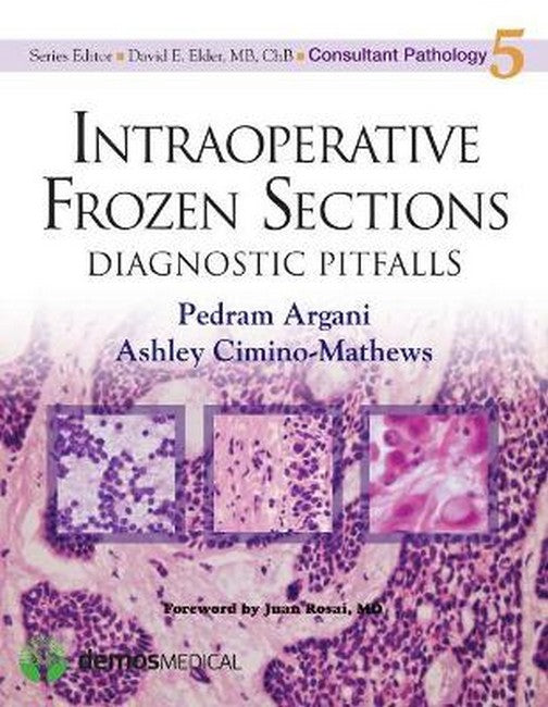 Intraoperative Frozen Sections